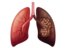 Damaged lungs